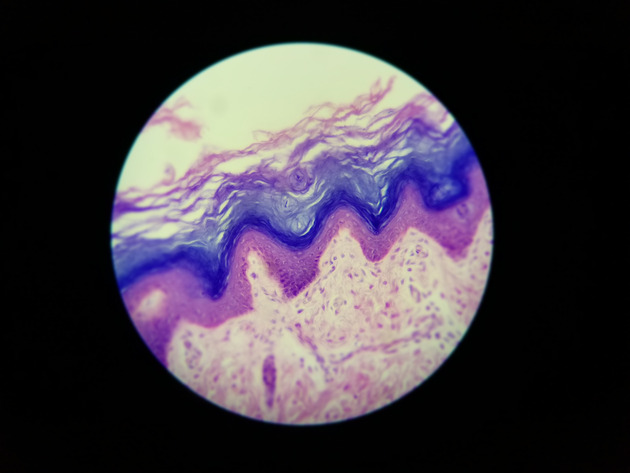 Stratified Squamous Epithelium Slides - Stratified Squamous Epithelium 12 400X